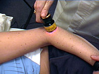 LLLT image 3